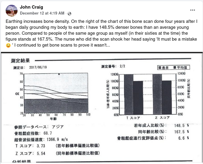 2021 1212 0419 john craig bone density