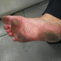 2019 jun 01 dirty sole of foot on grey tiles