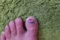 2021 apr 06 stubbed my toe getting into shower