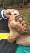 2022 mar 20 toe slice