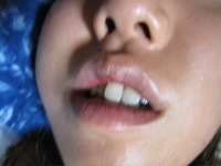 Ami's lips - 3