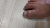 2021 apr 22 1444 banged right toenail