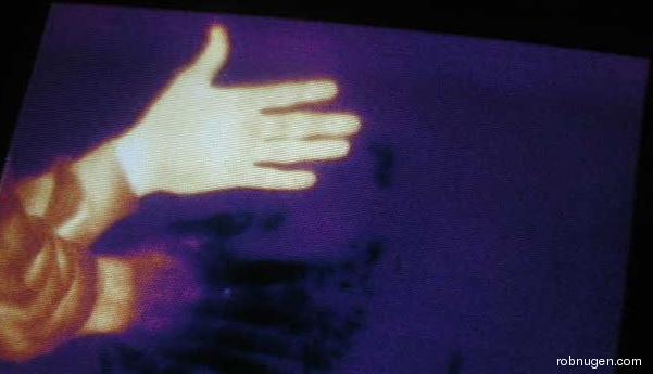 32216hot and cold hands