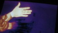 32216hot and cold hands